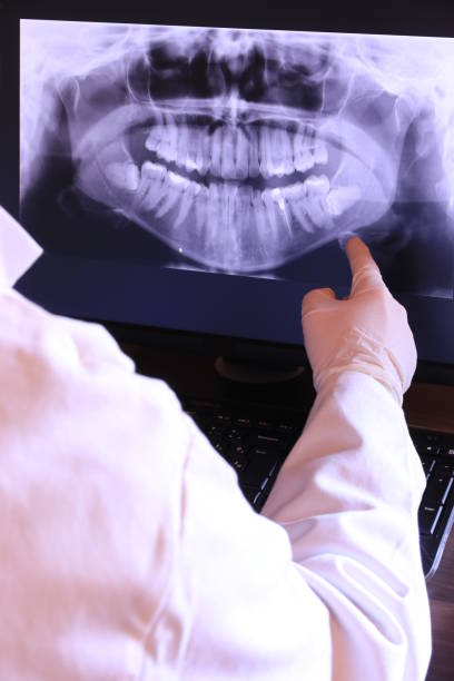 Best Root Canal Emergency Dentist  in Topeka, IN